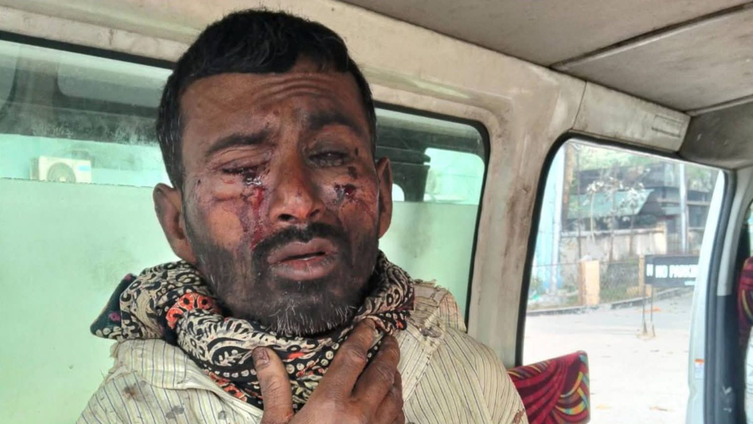 বেনাপোলের সীমান্ত এলাকায় মাটি খননকালে পুতে রাখা বোমা বিস্ফোরণে দুই শ্রমিক আহত