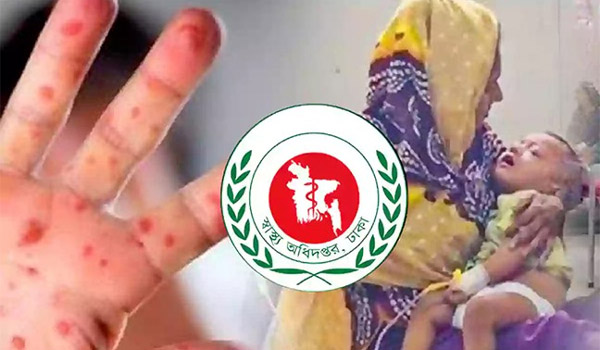 হাম ও হামের উপসর্গ নিয়ে আরও ৮ জনের মৃত্যু