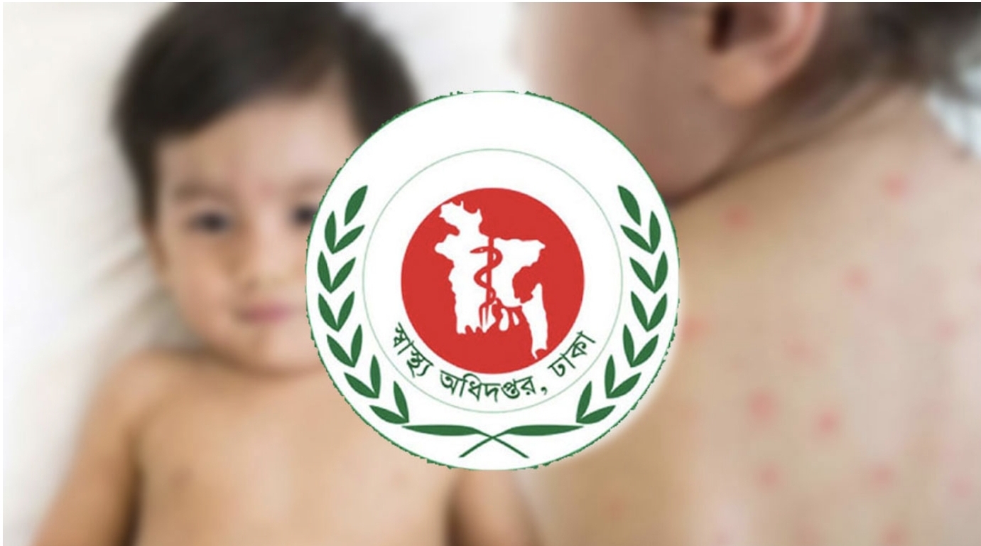 হাম ও উপসর্গে দেশে ২৪ ঘণ্টায় ১৭ শিশুর মৃত্যু