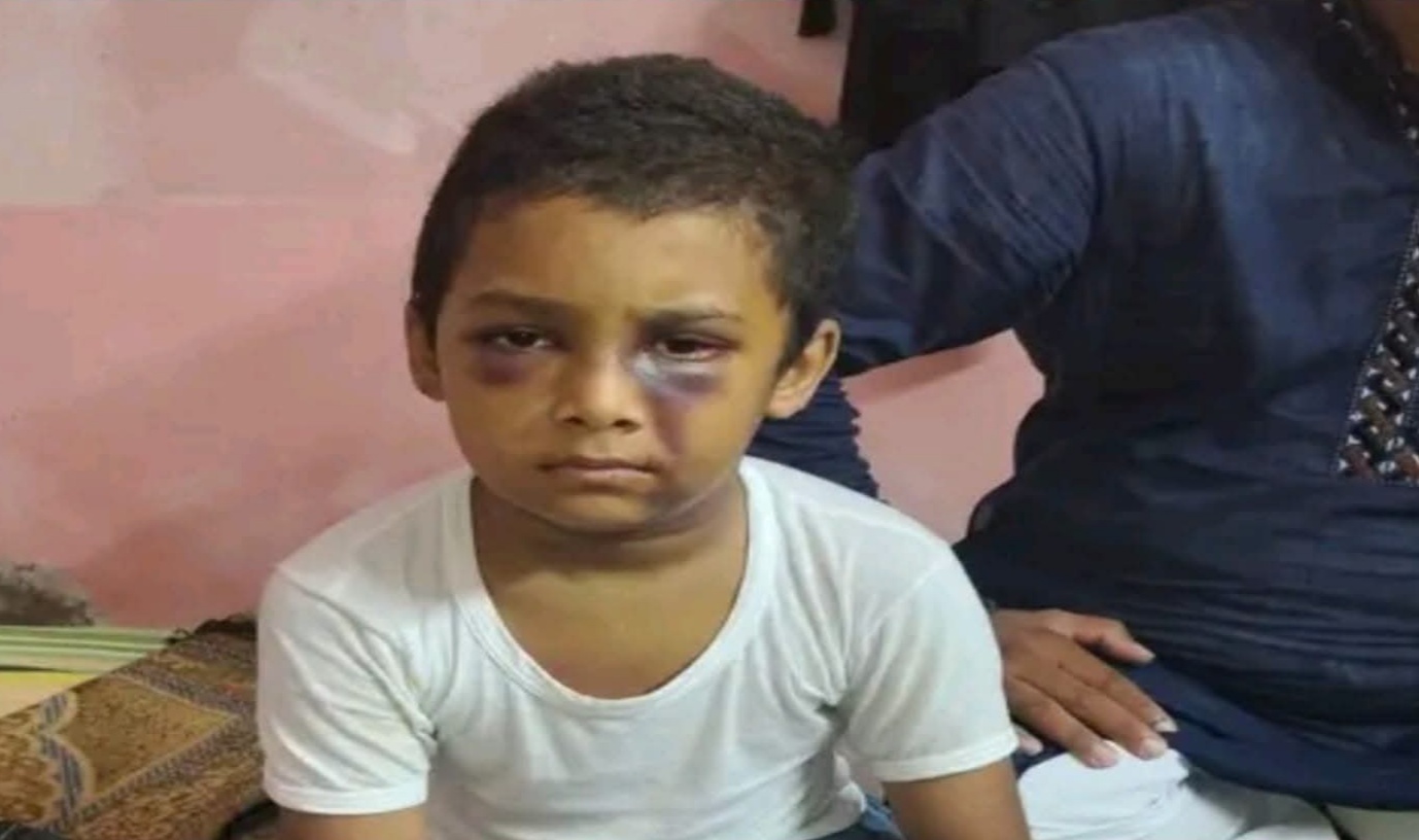 খুলনায় মাদ্রাসার শিক্ষার্থীকে নির্যাতনের অভিযোগ, ধামাচাপা দেওয়ায় -এলাকাজুড়ে ক্ষোভ