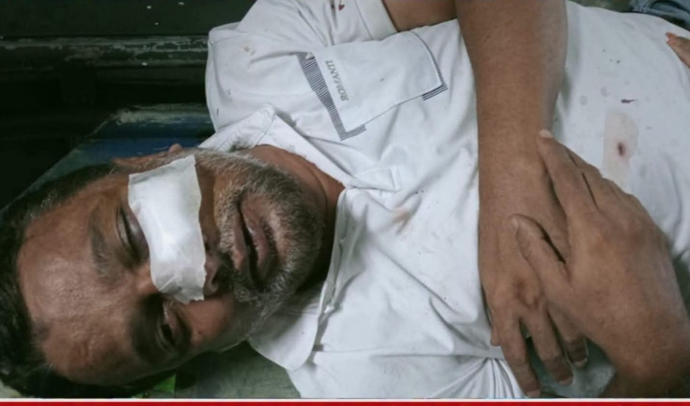 আদালতের নিষেধাজ্ঞা তোয়াক্কা না, সাংবাদিকের ওপর হামলা! খুমেকে ভর্তি রায়হান