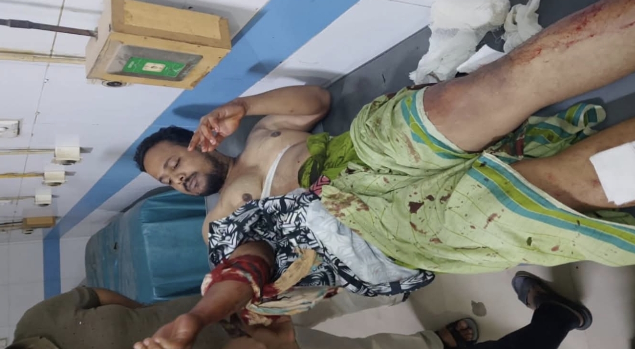 খুলনায় মাদক-সংক্রান্ত বিরোধে যুবককে কু/পি/য়ে গুরুতর জখম, ঢামেকে রেফার