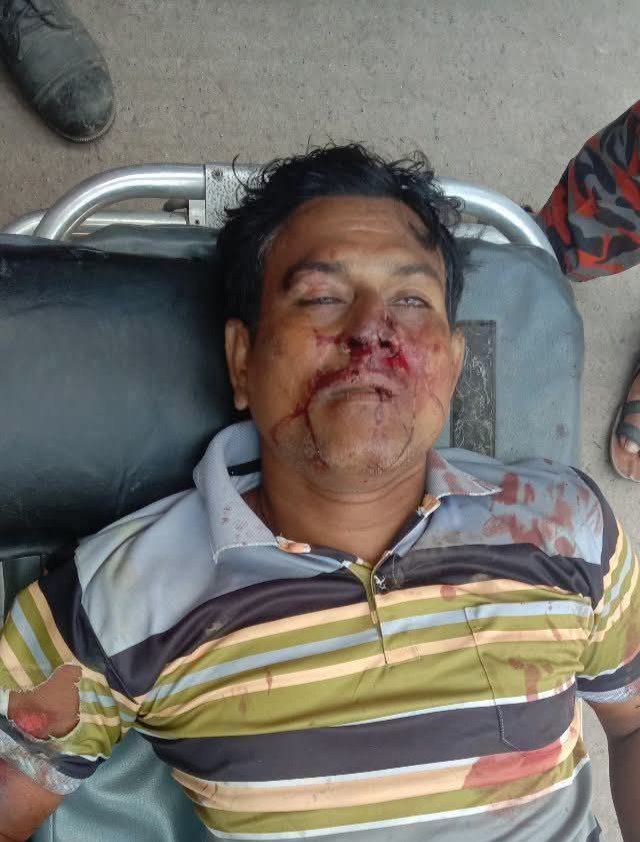 ডুমুরিয়ায় ট্রাকের ধাক্কায় মোটরসাইকেল আরোহী নিহত, আহত ১