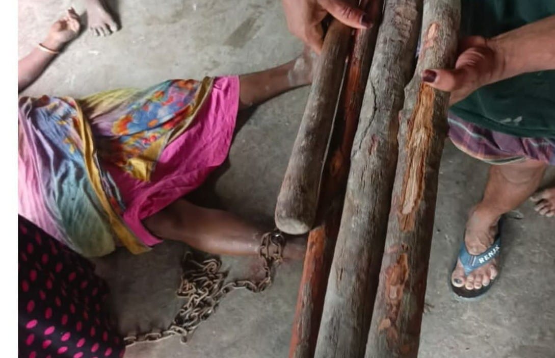 কয়রার গোলখালী গ্রামে গরানের লাঠি দিয়ে পিটিয়ে দুইজনের হাত-পা ভাঙার অভিযোগ, খুলনা মেডিকেলে প্রেরণ