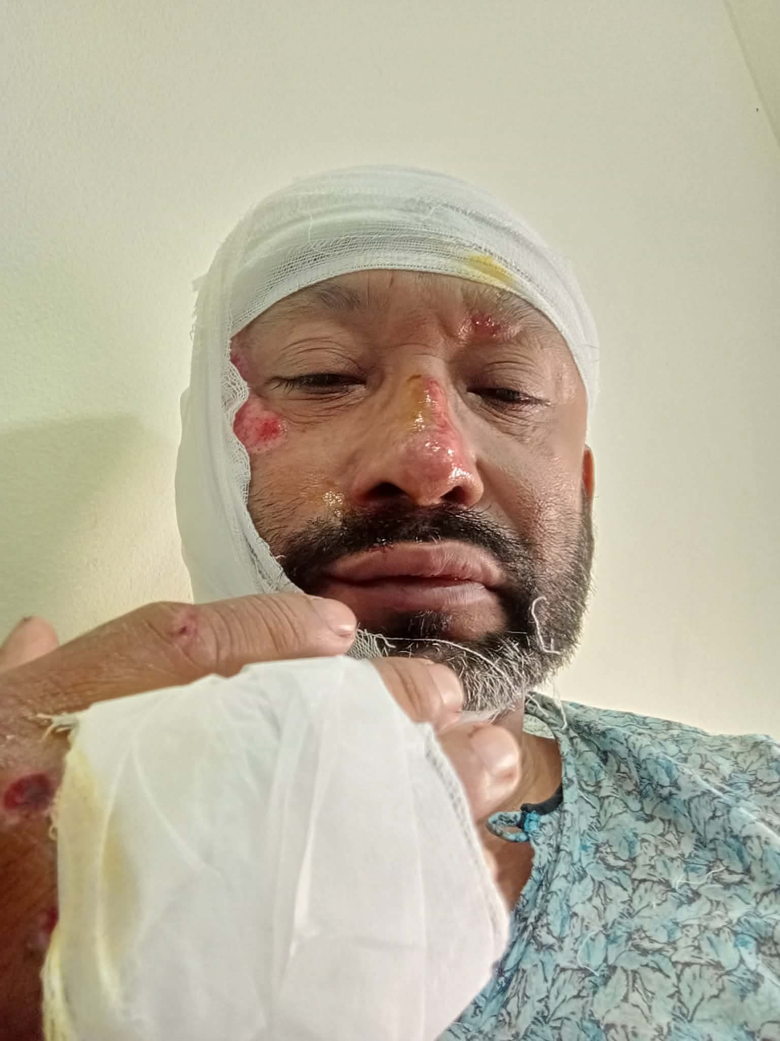 রোড এক্সিডেন্টে আহত সাংবাদিক আবুল মান্নান শেখ বাড়ি ফিরেছেন  
