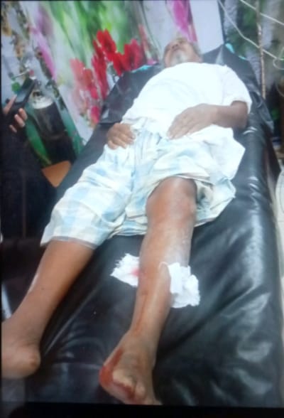 পোকখালীর মুসলিম বাজারে টমটম দূর্ঘটনার গুরুতর আহত-৩ 