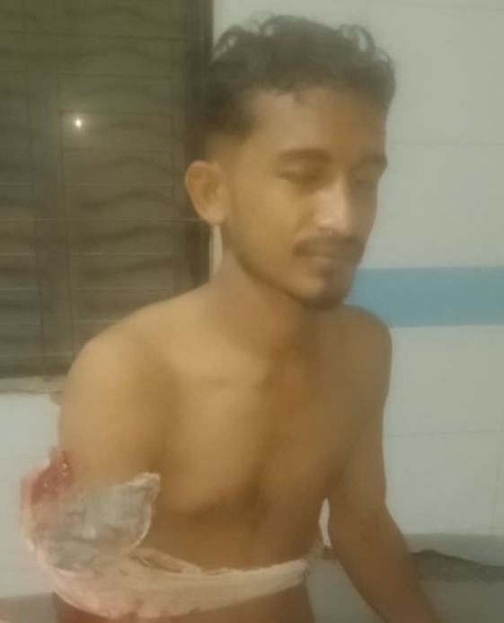নগরীর লবণচোরা এলাকায় যুবককে কুপিয়ে জখম